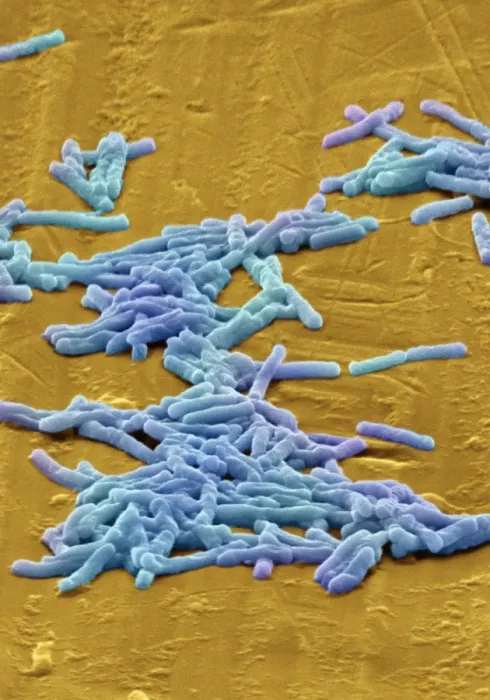 Impresión enmarcada : Bacterias de Clostridium difficile, SEM Impresión enmarcada : Bacterias de Clostridium difficile, SEM