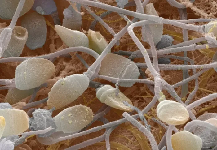 Impresión enmarcada : Esperma, SEM Impresión enmarcada : Esperma, SEM