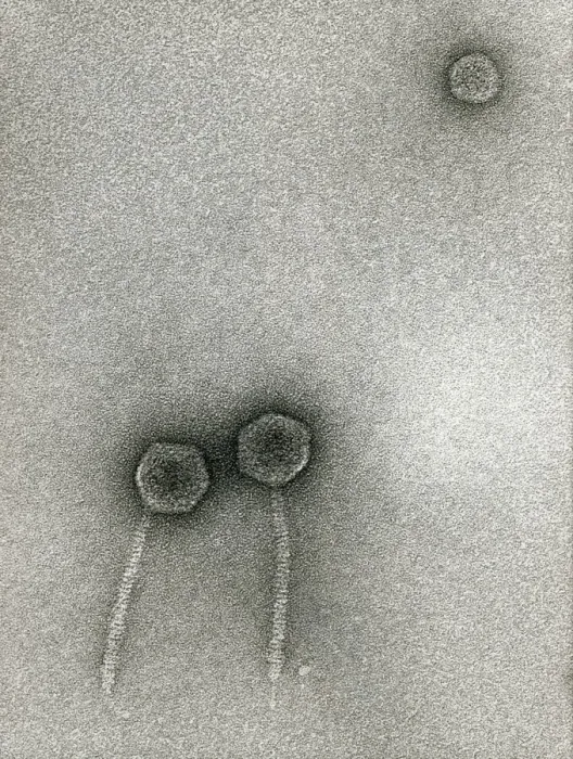 Impresión enmarcada : Fago de TEM del bacteriófago Lambda