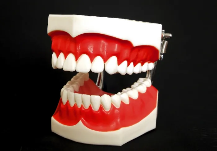 Impresión enmarcada : Modelo de dentadura postiza.