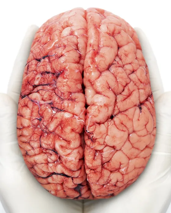 Impresión enmarcada : Cerebro humano