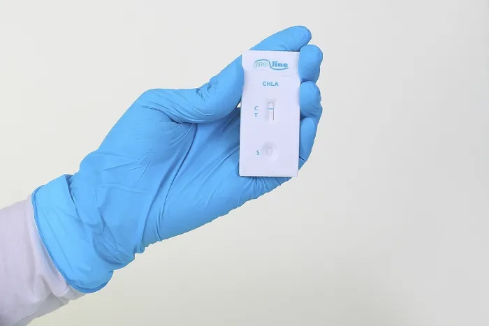 Impresión enmarcada : Prueba rápida de Clamidia de ProLine. Impresión enmarcada : Prueba rápida de Clamidia de ProLine.