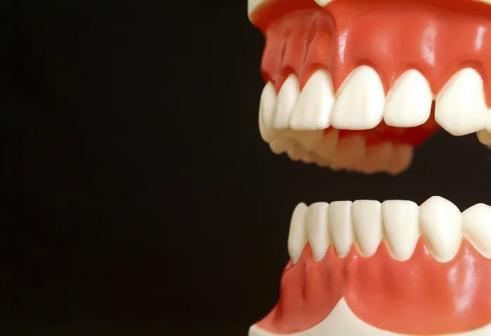 Impresión enmarcada : Teeth Impresión enmarcada : Teeth