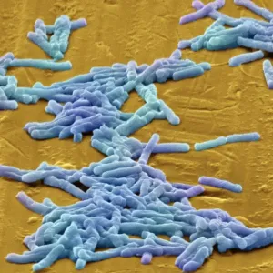 SEM Print of Clostridium difficile bacteria, coloured