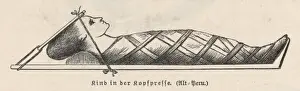 Historical Medical Equipment Imprime: Compression of Head
