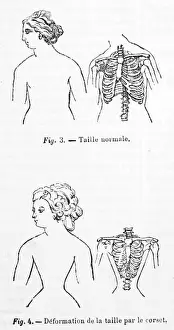 La Terrible Verdad Imprime: Influencia de los vestidos ajustados