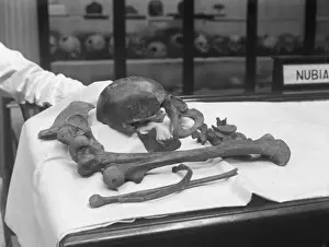 Medical Anatomy Imprime: Human Bones