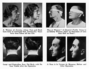 Plastic Surgery Before And After Imprime: Plastic Surgery - Before and After