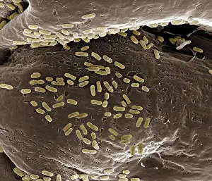 Scanning Electron Microscope Images Imprime: Scanning Electron Micrograph (SEM): E