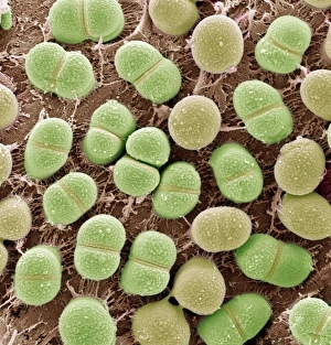 Coloured Scanning Electron Micrographs Imprime: Algae, SEM