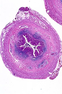 Impresiones de Anexos. Micrografía de luz de una sección troncal del apéndice humano Imágenes fechadas en mayo de 2013: Advertencia de anexos, fotomicrografo con luz C016 / 0510