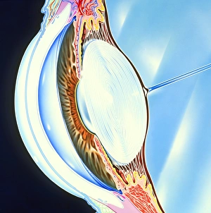 Imágenes fechadas el 6 de febrero de 2003: Diseño de la estructura del frente de un ojo