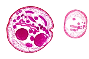 Light Micrograph Images Imprime: Ascaris roundworm, light micrograph