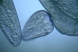 Protozoa Micrograph Imprime: Blepharisma protozoa, light micrograph
