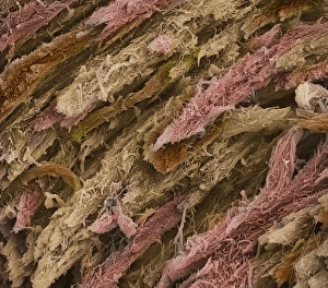 Impresiones de Hueso esponjoso. Micrografía de escaneo electrónico coloreada (SEM) de hueso esponjoso congelado fracturado Imágenes de octubre de 2001: Hueso, SEM.