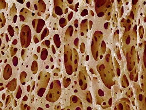 Impresiones de La tejido óseo es un material blando y flexible que se encuentra en el cuerpo humano Los micrografos de escaneo electrónico coloridos (SEM) Imágenes fechadas en septiembre de 2004: Tissue óseo