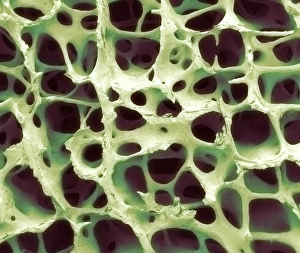 Cancellous Bone Structure Imprime: Bone tissue, SEM