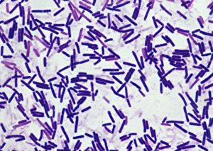 Imágenes fechadas el 5 de marzo de 2003: Bacterias de botulismo