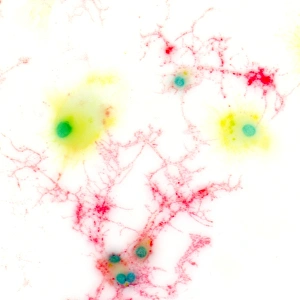 Brain Cell Structure Imprime: Brain cells, light micrograph