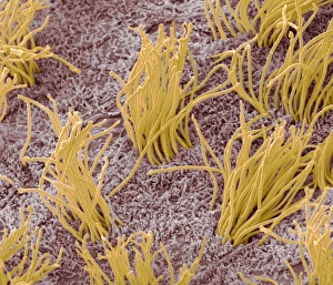 Imágenes fechadas en marzo de 2012: Mármol cerebral, SEM