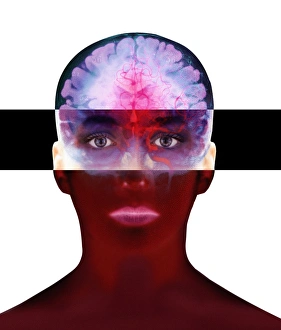Cerebral Cortex Structure Imprime: Brain scan