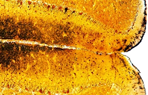 Light Microscopy Images Imprime: Brain tissue, light micrograph
