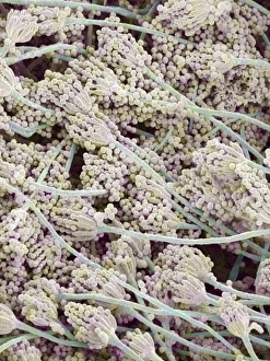 Coloured Scanning Electron Micrographs Imprime: Bread mould