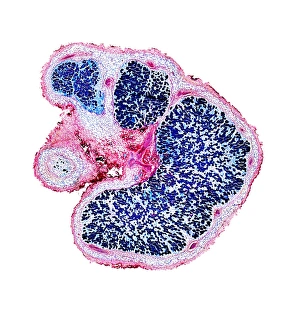 Light Microscopy Images Imprime: Broad bean root nodules, light micrograph