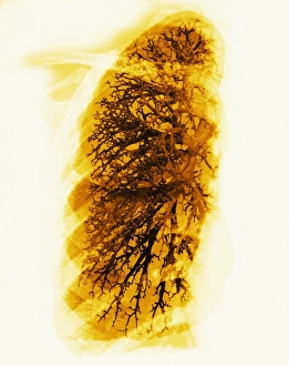 Lung Anatomy Imprime: Bronchioles