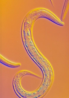 Imágenes de septiembre de 2002: Organo de gusano C.elegans