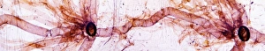 Light Microscopy Images Imprime: Caterpillar spiracles, light micrograph
