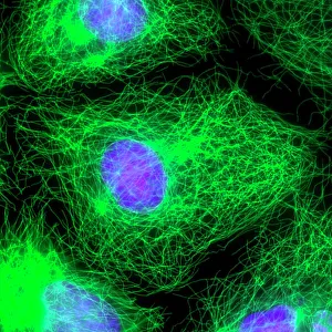 Impresiones de La división celular. Micrografía de luz fluorescente del epitelio humano (centro) durante la fase interfase de mitosis Imágenes de agosto de 2011: División celular, micrografía fluorescente