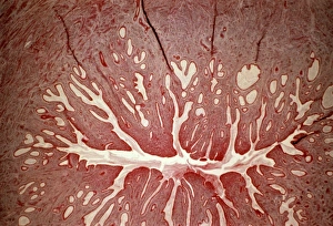 Female Reproductive System Anatomy Imprime: Cervix, light micrograph