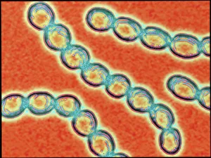 Imágenes fechadas el 26 de marzo de 2012: Cadenas de bacterias estreptocócicas del género Streptococcus pyogenes