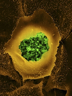 Coloured Scanning Electron Microscopy Imprime: Chlamydia, SEM