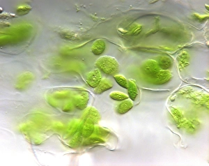 Photosynthesis Process Imprime: Chloroplasts, light micrograph