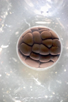 Cell Division Micrograph Imprime: Cleavage in frog egg, light micrograph