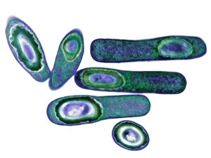 Antibiotic Resistant Bacteria Imprime: Clostridium difficile bacteria, TEM