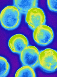 Imágenes fechadas el 19 de agosto de 2003: Cromosoma LM colorado de bacterias Halococcus