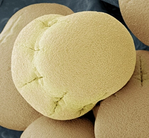 Pollen Grain Structure Imprime: Comfrey pollen, SEM