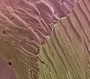 Knee Joint Anatomy Imprime: Compact bone, SEM