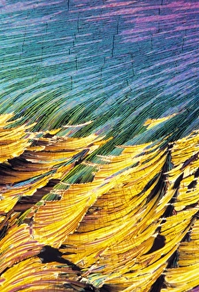 Polarised Light Microscopy Imprime: Cortisol crystals, light micrograph