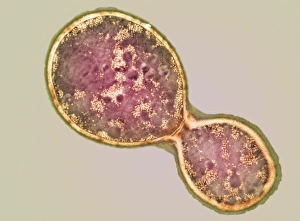 Impresiones de El hongo Criptococcus se divide celularmente Imágenes de agosto de 2002: Cristal de Cryptococcus dividiendo bajo el microscopio electrónico (TEM)