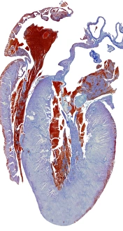 Heart Anatomy Imprime: Dissected heart, light micrograph