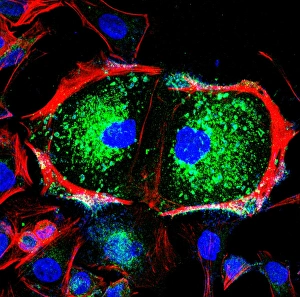 Light Micrograph Images Imprime: Dividing cell, light micrograph