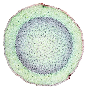 Vascular Bundle Structure Imprime: Dragon tree stem, light micrograph