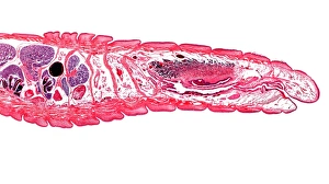 Lumbricus Terrestris Imprime: Earthworm, longitudinal section