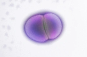 Electron Microscopy Images Imprime: Enterococcus faecalis dividing, TEM