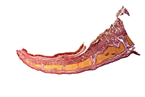 Impresiones de Epíglotis. Fotografía microscópica de una sección longitudinal del epíglotis, la placa de tejido ubicada en el extremo superior del laringeo (vocalizador) Imágenes fechadas en febrero de 2012: Epíglotis, micrografía de luz fina