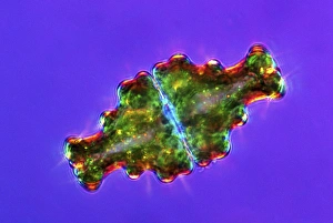 Polarised Light Microscopy Imprime: Euastrum desmids, light micrograph